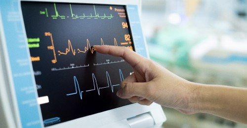 Atypical Heart Patterns