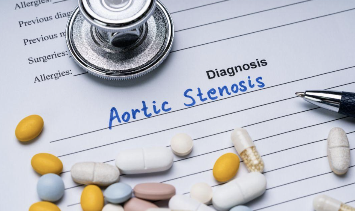 aortic stenosis - modern heart and vascular