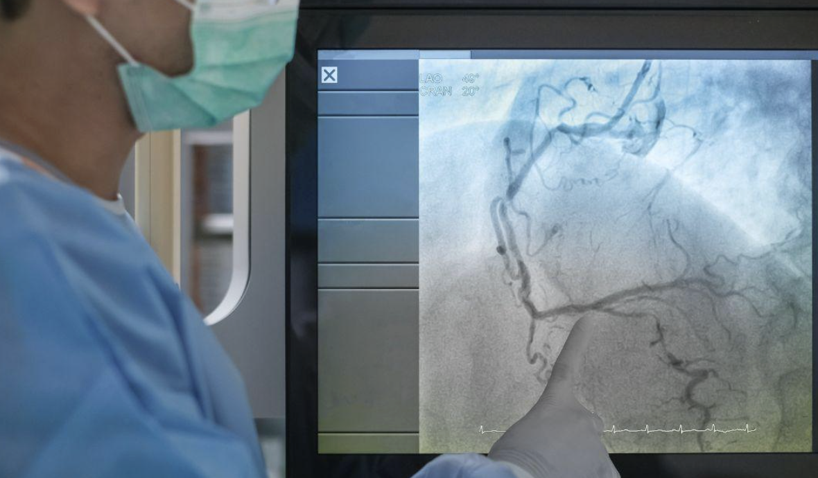 risks and side effects of a peripheral angiogram modern heart and vascular