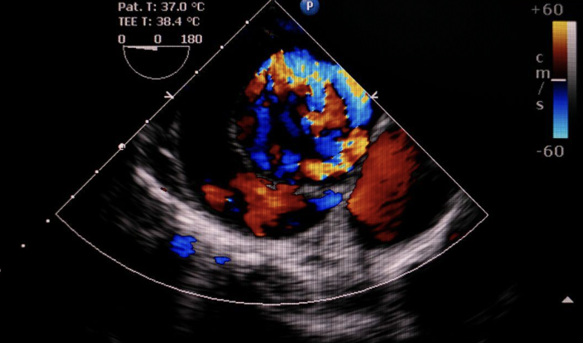 signs your child needs a pediatric echocardiogram