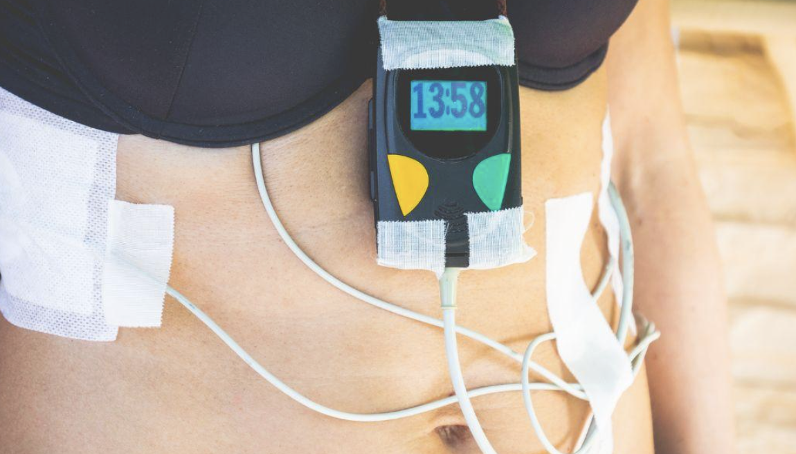 what is a holter monitor - modern heart and vascular