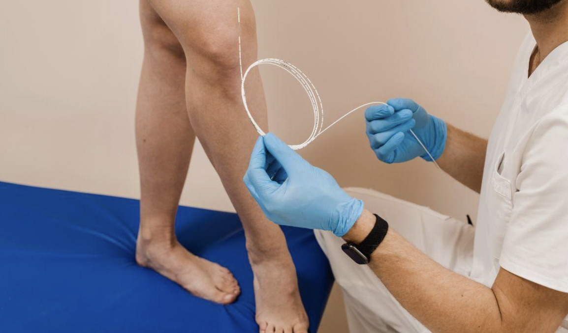 what is a venous insufficiency test - modern heart and vascular in houston, tx
