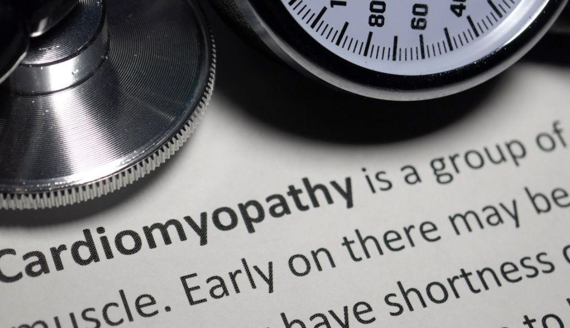 what is cardiomyopathy - modern heart and vascular