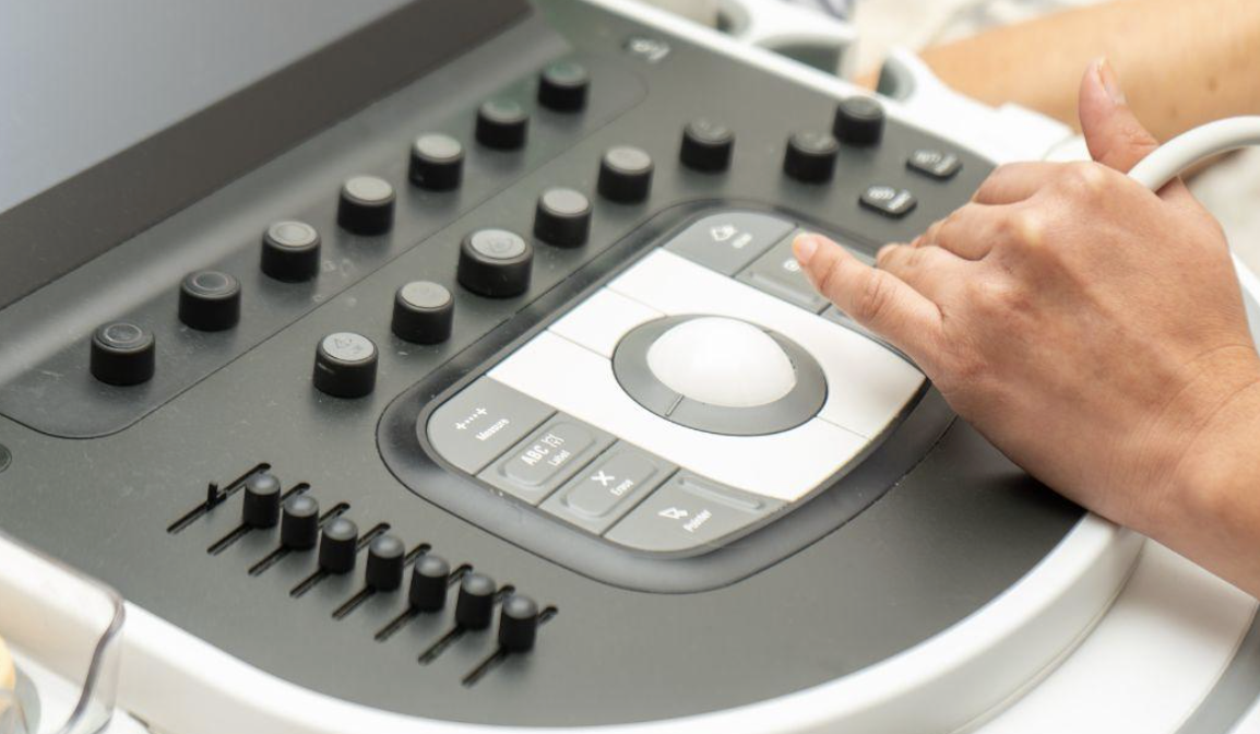 what to expect during a venous doppler